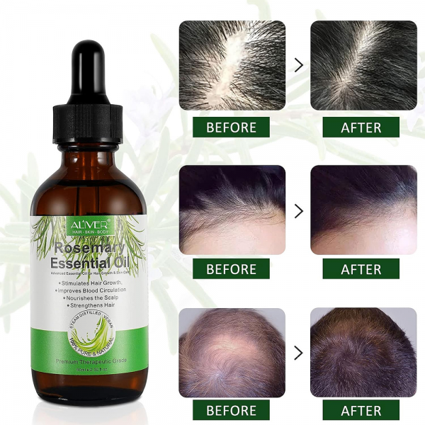 زيت أكليل الجبل لنمو الشعر Growth Hair Rosemary Essential Oil