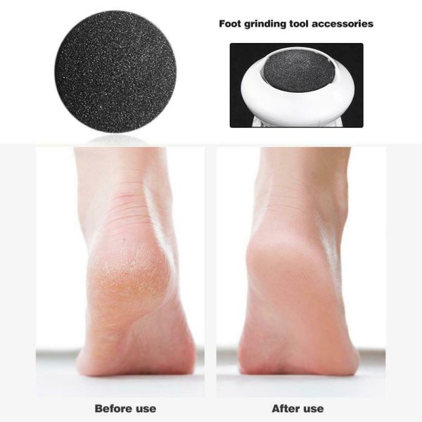 ⁦Dead skin feet remover مقشر القدم⁩ - الصورة ⁦4⁩