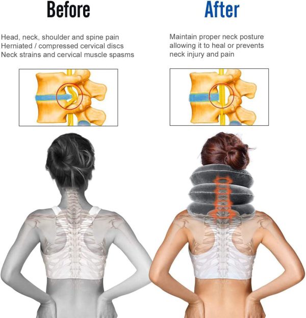 Neck Traction Device وسادة الرقبة الهوائية - الصورة 2