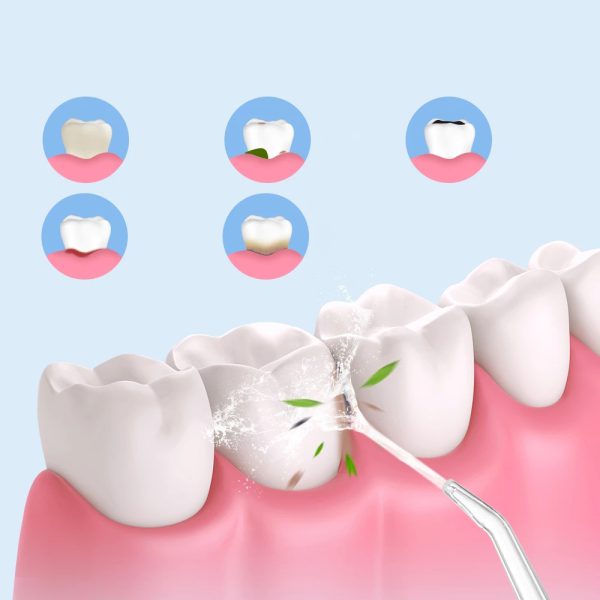 جهاز تنظيف الأسنان المائي water flosser - الصورة 3