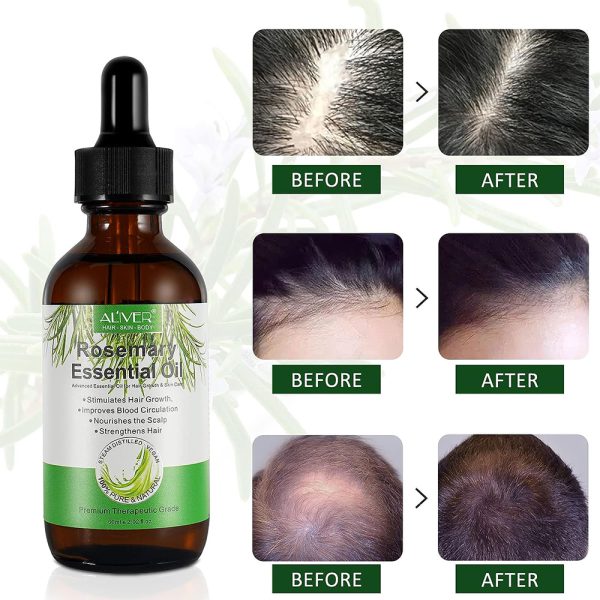 زيت أكليل الجبل لنمو الشعر - Growth Hair Rosemary Essential Oil - الصورة 3